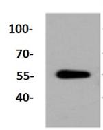 ALDH1A1 Antibody in Western Blot (WB)