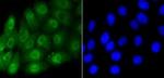 Phospho-SMAD5 (Ser463, Ser465) Recombinant Rabbit Monoclonal Antibody