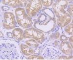 MCL1 Antibody in Immunohistochemistry (Paraffin) (IHC (P))