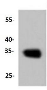 CNN1 Antibody in Western Blot (WB)