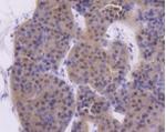 ATM Antibody in Immunohistochemistry (Paraffin) (IHC (P))