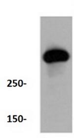 ATM Antibody in Western Blot (WB)