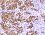 DES Antibody in Immunohistochemistry (Paraffin) (IHC (P))