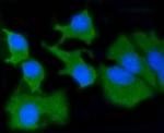 MMP14 Recombinant Rabbit Monoclonal Antibody