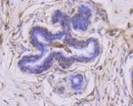 MMP14 Antibody in Immunohistochemistry (Paraffin) (IHC (P))