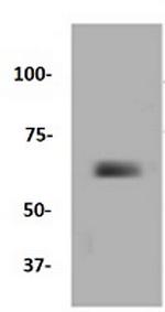 MMP14 Antibody in Western Blot (WB)
