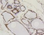 SUMO1 Antibody in Immunohistochemistry (Paraffin) (IHC (P))