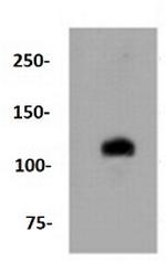 NOTCH1 Antibody in Western Blot (WB)