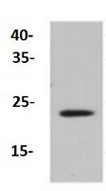 CAV2 Antibody in Western Blot (WB)