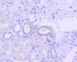 Phospho-EIF2AK2 (Thr446) Antibody in Immunohistochemistry (Paraffin) (IHC (P))