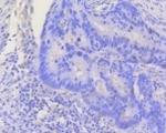 STAT3 Antibody in Immunohistochemistry (Paraffin) (IHC (P))