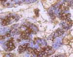 DNAJC15 Recombinant Rabbit Monoclonal Antibody