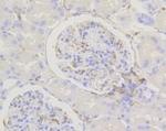 CALD1 Antibody in Immunohistochemistry (Paraffin) (IHC (P))
