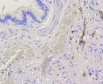 BAK1 Antibody in Immunohistochemistry (Paraffin) (IHC (P))