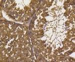 UBB Antibody in Immunohistochemistry (Paraffin) (IHC (P))