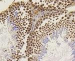 ASH2L Antibody in Immunohistochemistry (Paraffin) (IHC (P))
