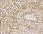 MAP1LC3A Antibody in Immunohistochemistry (Paraffin) (IHC (P))