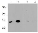 MAP1LC3A Antibody in Western Blot (WB)