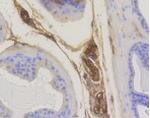 RAB5A Recombinant Rabbit Monoclonal Antibody