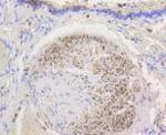 HK1 Antibody in Immunohistochemistry (Paraffin) (IHC (P))