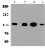 HK1 Antibody in Western Blot (WB)