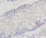 PIK3R2 Antibody in Immunohistochemistry (Paraffin) (IHC (P))