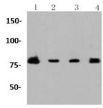PIK3R2 Antibody in Western Blot (WB)