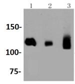 DNMT3A Antibody in Western Blot (WB)