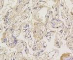 ARRB1 Antibody in Immunohistochemistry (Paraffin) (IHC (P))