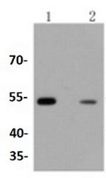 ARRB1 Antibody in Western Blot (WB)