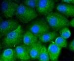 VTN Recombinant Rabbit Monoclonal Antibody