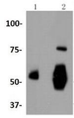 VTN Antibody in Western Blot (WB)