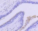 PRMT5 Antibody in Immunohistochemistry (Paraffin) (IHC (P))