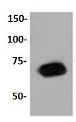 PRMT5 Antibody in Western Blot (WB)