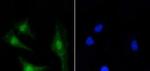 PRKCB Recombinant Rabbit Monoclonal Antibody