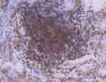 PRKCB Antibody in Immunohistochemistry (Paraffin) (IHC (P))