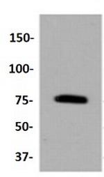 PRKCB Antibody in Western Blot (WB)