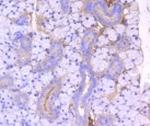 ROCK1 Antibody in Immunohistochemistry (Paraffin) (IHC (P))