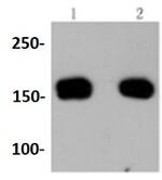 ROCK1 Antibody in Western Blot (WB)