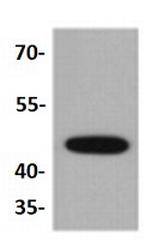 KRT15 Antibody in Western Blot (WB)