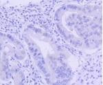 PIM1 Antibody in Immunohistochemistry (Paraffin) (IHC (P))