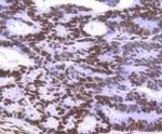H3-3A Antibody in Immunohistochemistry (Paraffin) (IHC (P))
