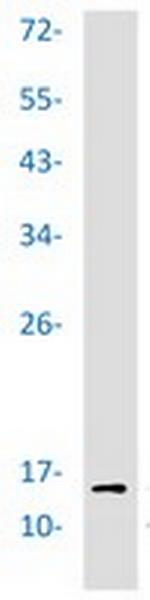 H3K14ac Recombinant Rabbit Monoclonal Antibody