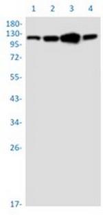 IDE Recombinant Rabbit Monoclonal Antibody