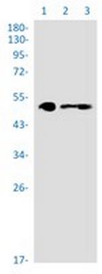 MEF2A/MEF2C Recombinant Rabbit Monoclonal Antibody