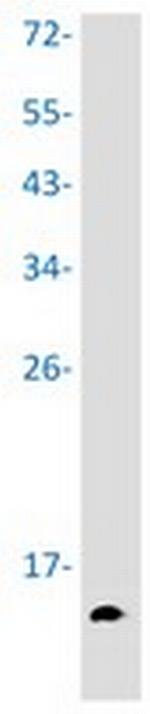 H4K5ac Recombinant Rabbit Monoclonal Antibody