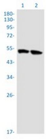 DAPK3 Recombinant Rabbit Monoclonal Antibody