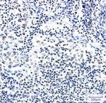 ZBTB7A Recombinant Rabbit Monoclonal Antibody