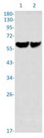 ZBTB7A Antibody in Western Blot (WB)