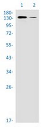 UBE4B Antibody in Western Blot (WB)